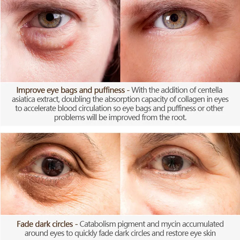 Eye contour cream: lifting effect in 2 minutes 