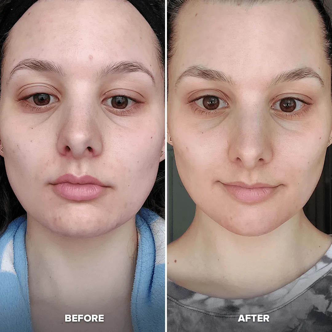 Glow & Go Bundle