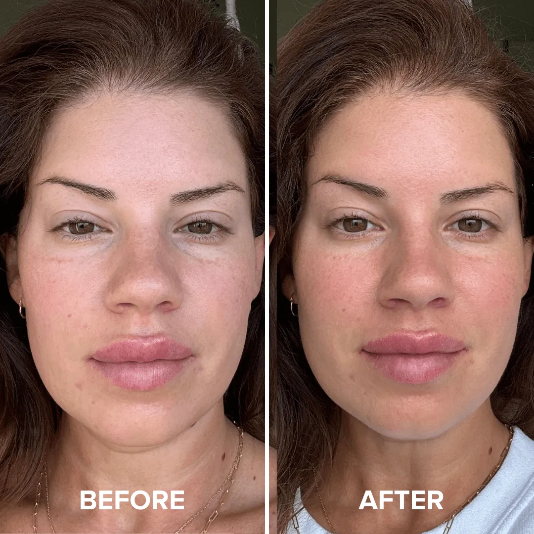 Glow & Go Bundle